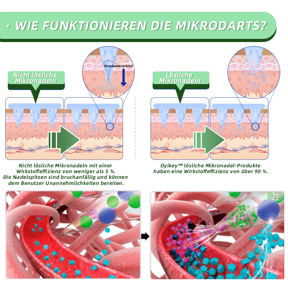 【Offiziell und authentisch】💉Oyikey™SMGT-GLP-1 Nano-Mikronadel-Pflaster(Schmerzfrei, lang anhaltend, gegen Diabetes, Fettleibigkeit und Herz-Kreislauf-Erkrankungen)