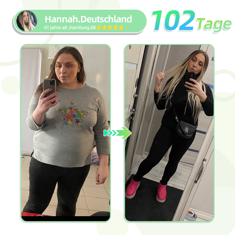 【Offiziell und authentisch】💉Oyikey™SMGT-GLP-1 Nano-Mikronadel-Pflaster(Schmerzfrei, lang anhaltend, gegen Diabetes, Fettleibigkeit und Herz-Kreislauf-Erkrankungen)