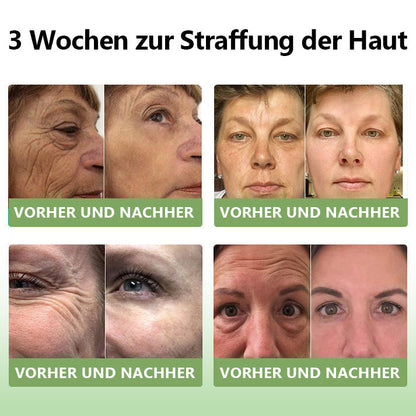 ✅ Offizieller Shop: STDEI™ Luxuriöse Kollagen-Festigungscreme  (BfArM-zertifiziert👨‍⚕️) | Strafft die Haut, Reduziert Falten, Kehrt Alterserscheinungen um