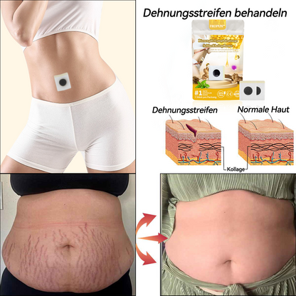 ✅Offizieller Laden:𝐅𝐑𝐎𝐏𝐔𝐍™ 👩‍⚕️Bienengift Lymphdrainage Schlankheitspflaster(TÜV) Clearance（Behandlung von Fettleibigkeit, schlaffer Haut, Krampfadern und Dehnungsstreifen）