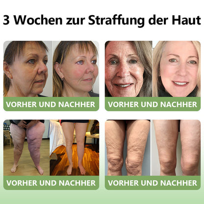 ✅ Offizieller Shop: STDEI™ Luxuriöse Kollagen-Festigungscreme  (BfArM-zertifiziert👨‍⚕️) | Strafft die Haut, Reduziert Falten, Kehrt Alterserscheinungen um