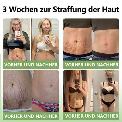 ✅ Offizieller Shop: STDEI™ Luxuriöse Kollagen-Festigungscreme  (BfArM-zertifiziert👨‍⚕️) | Strafft die Haut, Reduziert Falten, Kehrt Alterserscheinungen um