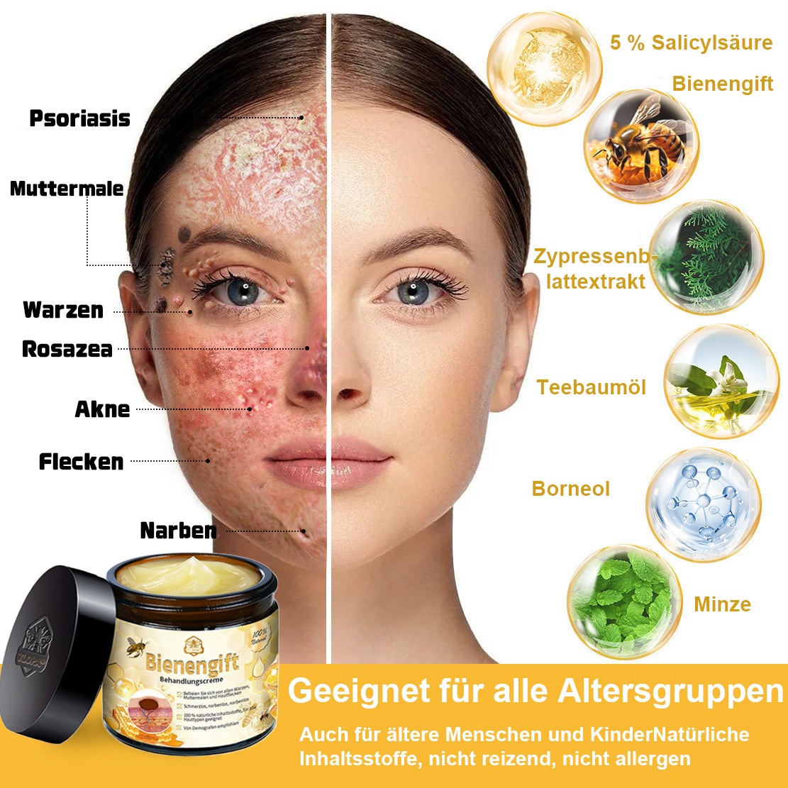 ✅[𝐎𝐟𝐟𝐢𝐳𝐢𝐞𝐥𝐥𝐞𝐫 𝐋𝐚𝐝𝐞𝐧]:5 Tage zu makelloser Haut 👩‍⚕️ 𝐷𝑜𝑟𝑚𝑜𝑟𝑛𝑎™𝑩𝒊𝒆𝒏𝒆𝒏𝒈𝒊𝒇𝒕 𝑴𝒂𝒖𝒍𝒘𝒖𝒓𝒇 & 𝑾𝒂𝒓𝒛𝒆 𝑬𝒏𝒕𝒇𝒆𝒓𝒏𝒖𝒏𝒈 𝑪𝒓𝒆𝒎𝒆 (𝐄𝐧𝐣𝐨𝐲 𝟑𝟎% 𝐨𝐟𝐟 𝐧𝐨𝐰! 𝐋𝐢𝐦𝐢𝐭𝐞𝐝 𝐭𝐢𝐦𝐞 𝐨𝐟𝐟𝐞𝐫!)