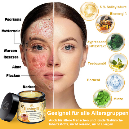 ✅[𝐎𝐟𝐟𝐢𝐳𝐢𝐞𝐥𝐥𝐞𝐫 𝐋𝐚𝐝𝐞𝐧]:5 Tage zu makelloser Haut 👩‍⚕️ 𝐷𝑜𝑟𝑚𝑜𝑟𝑛𝑎™𝑩𝒊𝒆𝒏𝒆𝒏𝒈𝒊𝒇𝒕 𝑴𝒂𝒖𝒍𝒘𝒖𝒓𝒇 & 𝑾𝒂𝒓𝒛𝒆 𝑬𝒏𝒕𝒇𝒆𝒓𝒏𝒖𝒏𝒈 𝑪𝒓𝒆𝒎𝒆 (𝐄𝐧𝐣𝐨𝐲 𝟑𝟎% 𝐨𝐟𝐟 𝐧𝐨𝐰! 𝐋𝐢𝐦𝐢𝐭𝐞𝐝 𝐭𝐢𝐦𝐞 𝐨𝐟𝐟𝐞𝐫!)
