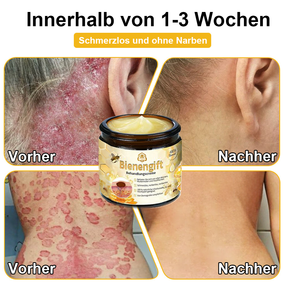 ✅[𝐎𝐟𝐟𝐢𝐳𝐢𝐞𝐥𝐥𝐞𝐫 𝐋𝐚𝐝𝐞𝐧]:5 Tage zu makelloser Haut 👩‍⚕️ 𝐷𝑜𝑟𝑚𝑜𝑟𝑛𝑎™𝑩𝒊𝒆𝒏𝒆𝒏𝒈𝒊𝒇𝒕 𝑴𝒂𝒖𝒍𝒘𝒖𝒓𝒇 & 𝑾𝒂𝒓𝒛𝒆 𝑬𝒏𝒕𝒇𝒆𝒓𝒏𝒖𝒏𝒈 𝑪𝒓𝒆𝒎𝒆 (𝐄𝐧𝐣𝐨𝐲 𝟑𝟎% 𝐨𝐟𝐟 𝐧𝐨𝐰! 𝐋𝐢𝐦𝐢𝐭𝐞𝐝 𝐭𝐢𝐦𝐞 𝐨𝐟𝐟𝐞𝐫!)