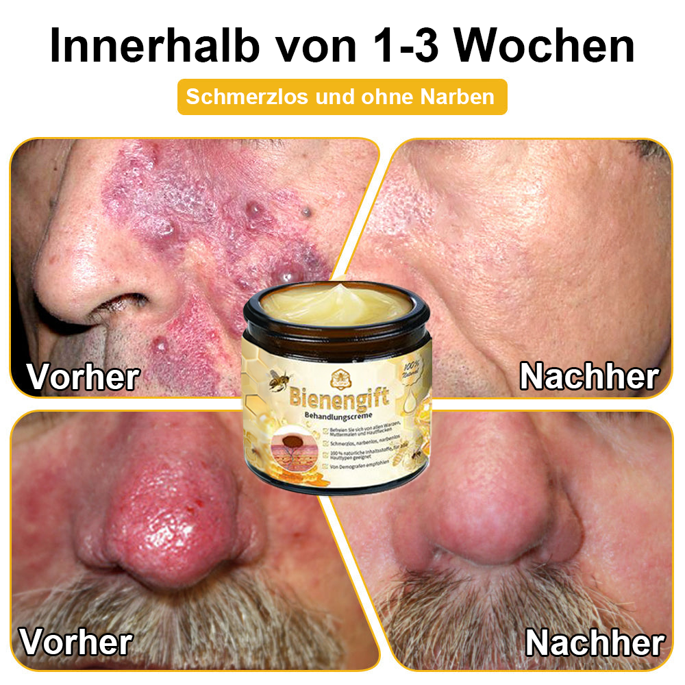 ✅[𝐎𝐟𝐟𝐢𝐳𝐢𝐞𝐥𝐥𝐞𝐫 𝐋𝐚𝐝𝐞𝐧]:5 Tage zu makelloser Haut 👩‍⚕️ 𝐷𝑜𝑟𝑚𝑜𝑟𝑛𝑎™𝑩𝒊𝒆𝒏𝒆𝒏𝒈𝒊𝒇𝒕 𝑴𝒂𝒖𝒍𝒘𝒖𝒓𝒇 & 𝑾𝒂𝒓𝒛𝒆 𝑬𝒏𝒕𝒇𝒆𝒓𝒏𝒖𝒏𝒈 𝑪𝒓𝒆𝒎𝒆 (𝐄𝐧𝐣𝐨𝐲 𝟑𝟎% 𝐨𝐟𝐟 𝐧𝐨𝐰! 𝐋𝐢𝐦𝐢𝐭𝐞𝐝 𝐭𝐢𝐦𝐞 𝐨𝐟𝐟𝐞𝐫!)