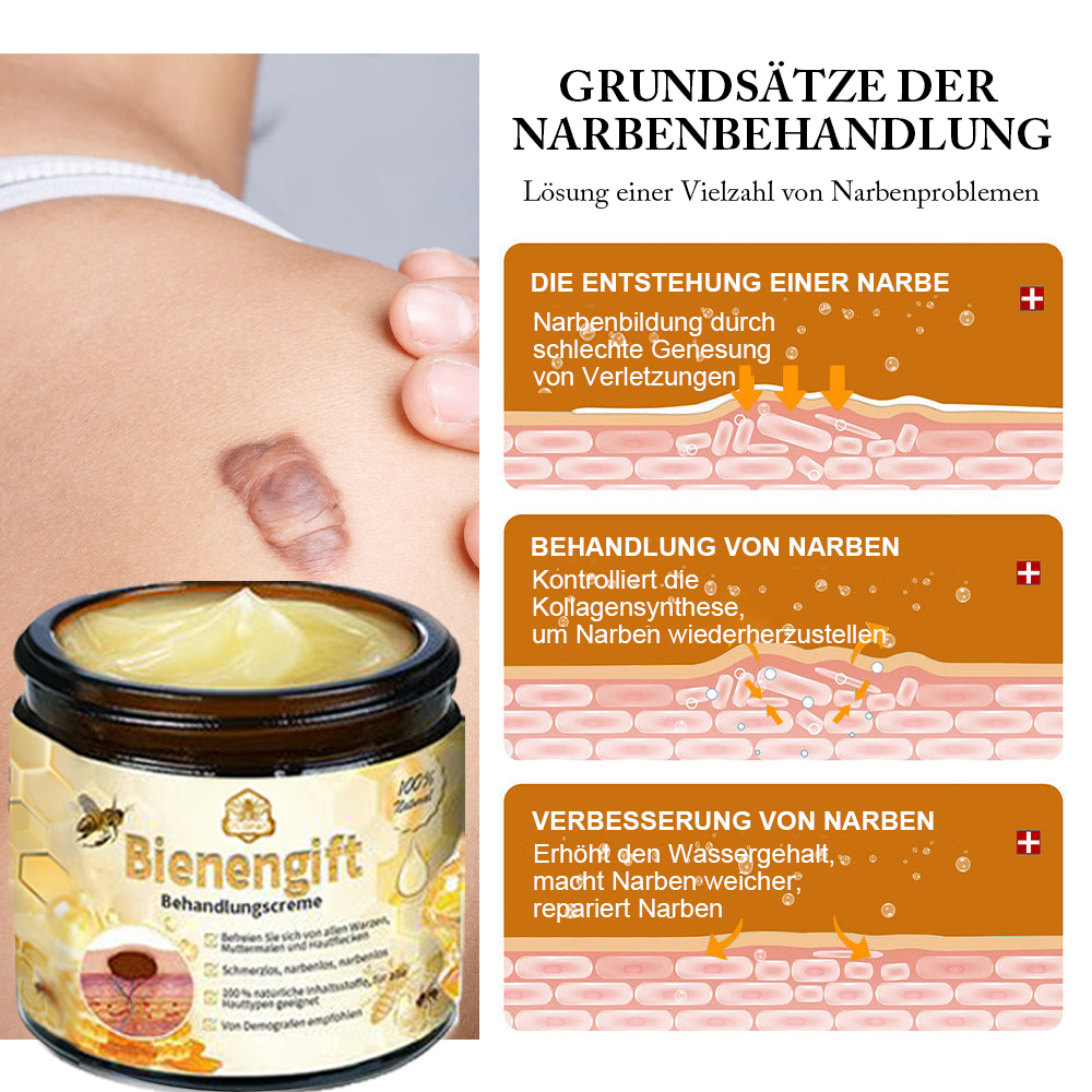 ✅[𝐎𝐟𝐟𝐢𝐳𝐢𝐞𝐥𝐥𝐞𝐫 𝐋𝐚𝐝𝐞𝐧]:5 Tage zu makelloser Haut 👩‍⚕️ 𝐷𝑜𝑟𝑚𝑜𝑟𝑛𝑎™𝑩𝒊𝒆𝒏𝒆𝒏𝒈𝒊𝒇𝒕 𝑴𝒂𝒖𝒍𝒘𝒖𝒓𝒇 & 𝑾𝒂𝒓𝒛𝒆 𝑬𝒏𝒕𝒇𝒆𝒓𝒏𝒖𝒏𝒈 𝑪𝒓𝒆𝒎𝒆 (𝐄𝐧𝐣𝐨𝐲 𝟑𝟎% 𝐨𝐟𝐟 𝐧𝐨𝐰! 𝐋𝐢𝐦𝐢𝐭𝐞𝐝 𝐭𝐢𝐦𝐞 𝐨𝐟𝐟𝐞𝐫!)