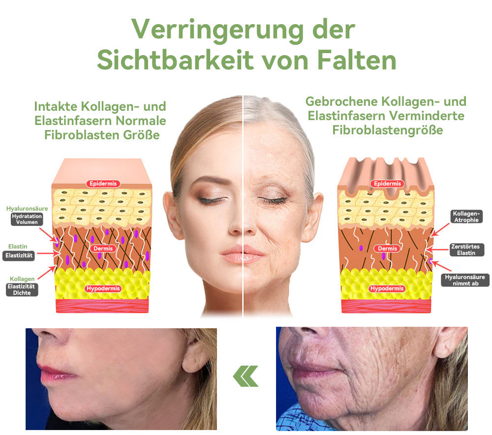 ✅ Offizieller Shop: STDEI™ Luxuriöse Kollagen-Festigungscreme  (BfArM-zertifiziert👨‍⚕️) | Strafft die Haut, Reduziert Falten, Kehrt Alterserscheinungen um