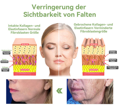 ✅ Offizieller Shop: STDEI™ Luxuriöse Kollagen-Festigungscreme  (BfArM-zertifiziert👨‍⚕️) | Strafft die Haut, Reduziert Falten, Kehrt Alterserscheinungen um