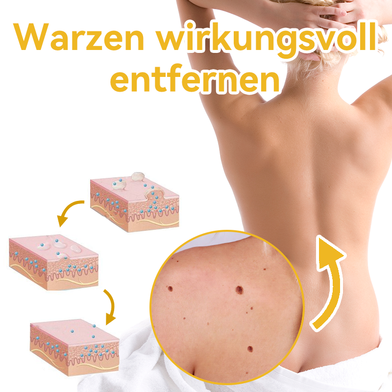 ✅[𝐎𝐟𝐟𝐢𝐳𝐢𝐞𝐥𝐥𝐞𝐫 𝐋𝐚𝐝𝐞𝐧]:5 Tage zu makelloser Haut 👨‍⚕️ 𝐷𝑜𝑟𝑚𝑜𝑟𝑛𝑎™𝑩𝒊𝒆𝒏𝒆𝒏𝒈𝒊𝒇𝒕 𝑴𝒂𝒖𝒍𝒘𝒖𝒓𝒇 & 𝑾𝒂𝒓𝒛𝒆 𝑬𝒏𝒕𝒇𝒆𝒓𝒏𝒖𝒏𝒈 𝑪𝒓𝒆𝒎𝒆 (𝐄𝐧𝐣𝐨𝐲 𝟑𝟎% 𝐨𝐟𝐟 𝐧𝐨𝐰! 𝐋𝐢𝐦𝐢𝐭𝐞𝐝 𝐭𝐢𝐦𝐞 𝐨𝐟𝐟𝐞𝐫!)