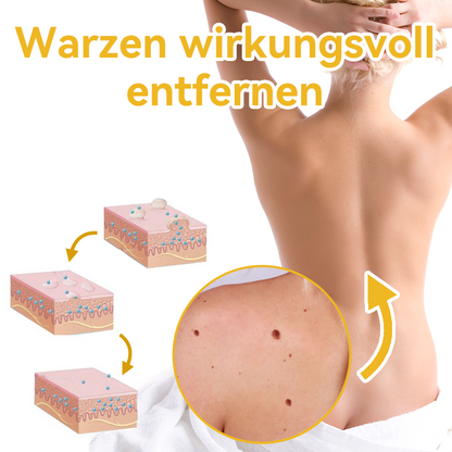 ✅[𝐎𝐟𝐟𝐢𝐳𝐢𝐞𝐥𝐥𝐞𝐫 𝐋𝐚𝐝𝐞𝐧]:5 Tage zu makelloser Haut 👨‍⚕️ 𝐷𝑜𝑟𝑚𝑜𝑟𝑛𝑎™𝑩𝒊𝒆𝒏𝒆𝒏𝒈𝒊𝒇𝒕 𝑴𝒂𝒖𝒍𝒘𝒖𝒓𝒇 & 𝑾𝒂𝒓𝒛𝒆 𝑬𝒏𝒕𝒇𝒆𝒓𝒏𝒖𝒏𝒈 𝑪𝒓𝒆𝒎𝒆 (𝐄𝐧𝐣𝐨𝐲 𝟑𝟎% 𝐨𝐟𝐟 𝐧𝐨𝐰! 𝐋𝐢𝐦𝐢𝐭𝐞𝐝 𝐭𝐢𝐦𝐞 𝐨𝐟𝐟𝐞𝐫!)