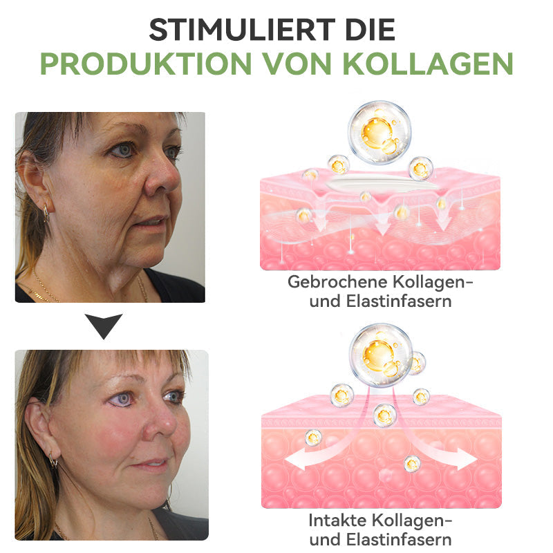 ✅ Offizieller Shop: STDEI™ Luxuriöse Kollagen-Festigungscreme  (BfArM-zertifiziert👨‍⚕️) | Strafft die Haut, Reduziert Falten, Kehrt Alterserscheinungen um