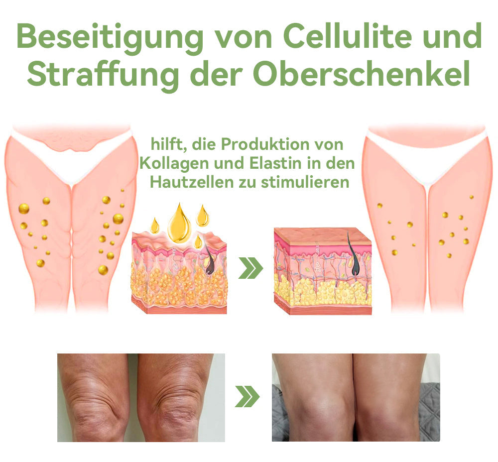 ✅ Offizieller Shop: STDEI™ Luxuriöse Kollagen-Festigungscreme  (BfArM-zertifiziert👨‍⚕️) | Strafft die Haut, Reduziert Falten, Kehrt Alterserscheinungen um