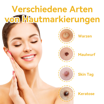 ✅[𝐎𝐟𝐟𝐢𝐳𝐢𝐞𝐥𝐥𝐞𝐫 𝐋𝐚𝐝𝐞𝐧]:5 Tage zu makelloser Haut 👨‍⚕️ 𝐷𝑜𝑟𝑚𝑜𝑟𝑛𝑎™𝑩𝒊𝒆𝒏𝒆𝒏𝒈𝒊𝒇𝒕 𝑴𝒂𝒖𝒍𝒘𝒖𝒓𝒇 & 𝑾𝒂𝒓𝒛𝒆 𝑬𝒏𝒕𝒇𝒆𝒓𝒏𝒖𝒏𝒈 𝑪𝒓𝒆𝒎𝒆 (𝐄𝐧𝐣𝐨𝐲 𝟑𝟎% 𝐨𝐟𝐟 𝐧𝐨𝐰! 𝐋𝐢𝐦𝐢𝐭𝐞𝐝 𝐭𝐢𝐦𝐞 𝐨𝐟𝐟𝐞𝐫!)