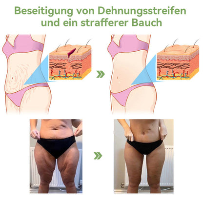 ✅ Offizieller Shop: STDEI™ Luxuriöse Kollagen-Festigungscreme  (BfArM-zertifiziert👨‍⚕️) | Strafft die Haut, Reduziert Falten, Kehrt Alterserscheinungen um