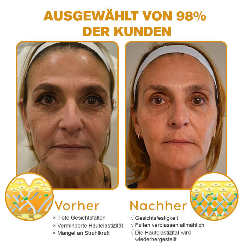 (✨ Hergestellt und versendet aus Deutschland ✅) 𝐒𝐩𝐳𝐯™ 𝐁𝐨𝐭𝐨𝐱 Bienengift Faltenentfernungscreme - Letzter Tag 70% Rabatt