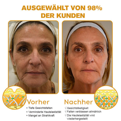 ✅𝐌𝐚𝐫𝐤𝐞𝐧𝐬𝐡𝐨𝐩 : 𝐒𝐩𝐳𝐯™ 👩‍⚕️🥇Botox Bienengift Faltencreme (🔥50% Rabatt für begrenzte Zeit!)