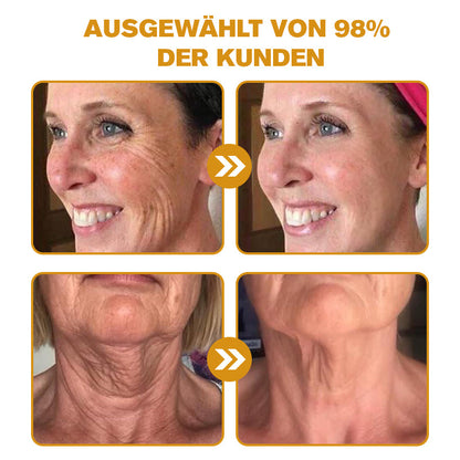 ✅𝐌𝐚𝐫𝐤𝐞𝐧𝐬𝐡𝐨𝐩 : 𝐒𝐩𝐳𝐯™ 👩‍⚕️🥇Botox Bienengift Faltencreme (🔥50% Rabatt für begrenzte Zeit!)