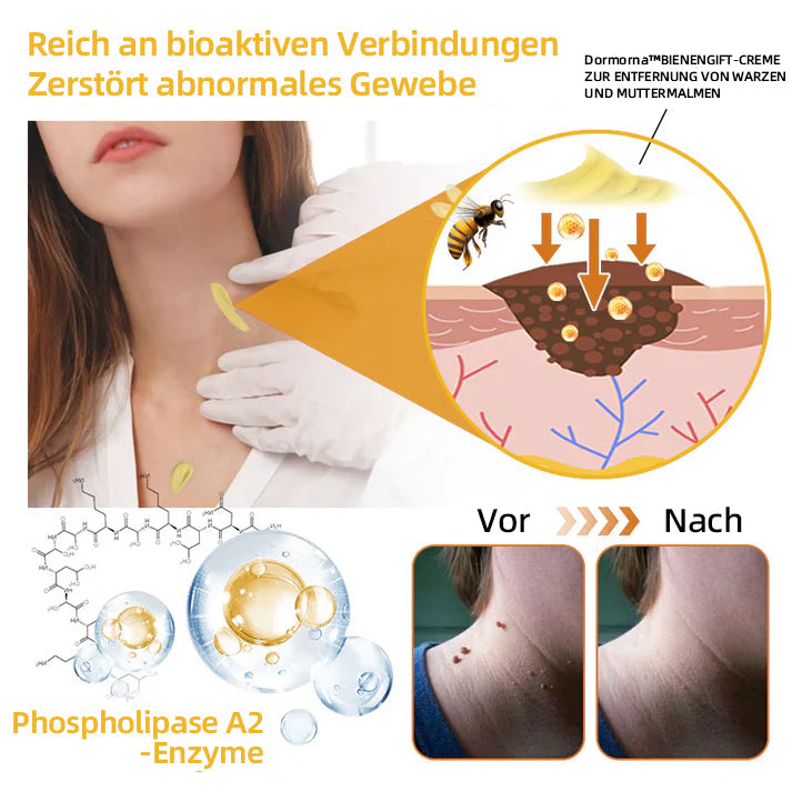 ✅[𝐎𝐟𝐟𝐢𝐳𝐢𝐞𝐥𝐥𝐞𝐫 𝐋𝐚𝐝𝐞𝐧]:5 Tage zu makelloser Haut 👨‍⚕️ 𝐷𝑜𝑟𝑚𝑜𝑟𝑛𝑎™𝑩𝒊𝒆𝒏𝒆𝒏𝒈𝒊𝒇𝒕 𝑴𝒂𝒖𝒍𝒘𝒖𝒓𝒇 & 𝑾𝒂𝒓𝒛𝒆 𝑬𝒏𝒕𝒇𝒆𝒓𝒏𝒖𝒏𝒈 𝑪𝒓𝒆𝒎𝒆 (𝐄𝐧𝐣𝐨𝐲 𝟑𝟎% 𝐨𝐟𝐟 𝐧𝐨𝐰! 𝐋𝐢𝐦𝐢𝐭𝐞𝐝 𝐭𝐢𝐦𝐞 𝐨𝐟𝐟𝐞𝐫!)