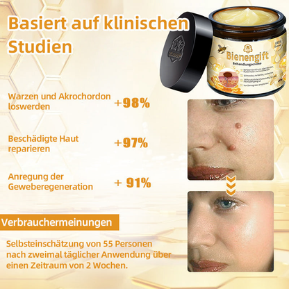 ✅[𝐎𝐟𝐟𝐢𝐳𝐢𝐞𝐥𝐥𝐞𝐫 𝐋𝐚𝐝𝐞𝐧]:5 Tage zu makelloser Haut 👩‍⚕️ 𝐷𝑜𝑟𝑚𝑜𝑟𝑛𝑎™𝑩𝒊𝒆𝒏𝒆𝒏𝒈𝒊𝒇𝒕 𝑴𝒂𝒖𝒍𝒘𝒖𝒓𝒇 & 𝑾𝒂𝒓𝒛𝒆 𝑬𝒏𝒕𝒇𝒆𝒓𝒏𝒖𝒏𝒈 𝑪𝒓𝒆𝒎𝒆 (𝐄𝐧𝐣𝐨𝐲 𝟑𝟎% 𝐨𝐟𝐟 𝐧𝐨𝐰! 𝐋𝐢𝐦𝐢𝐭𝐞𝐝 𝐭𝐢𝐦𝐞 𝐨𝐟𝐟𝐞𝐫!)