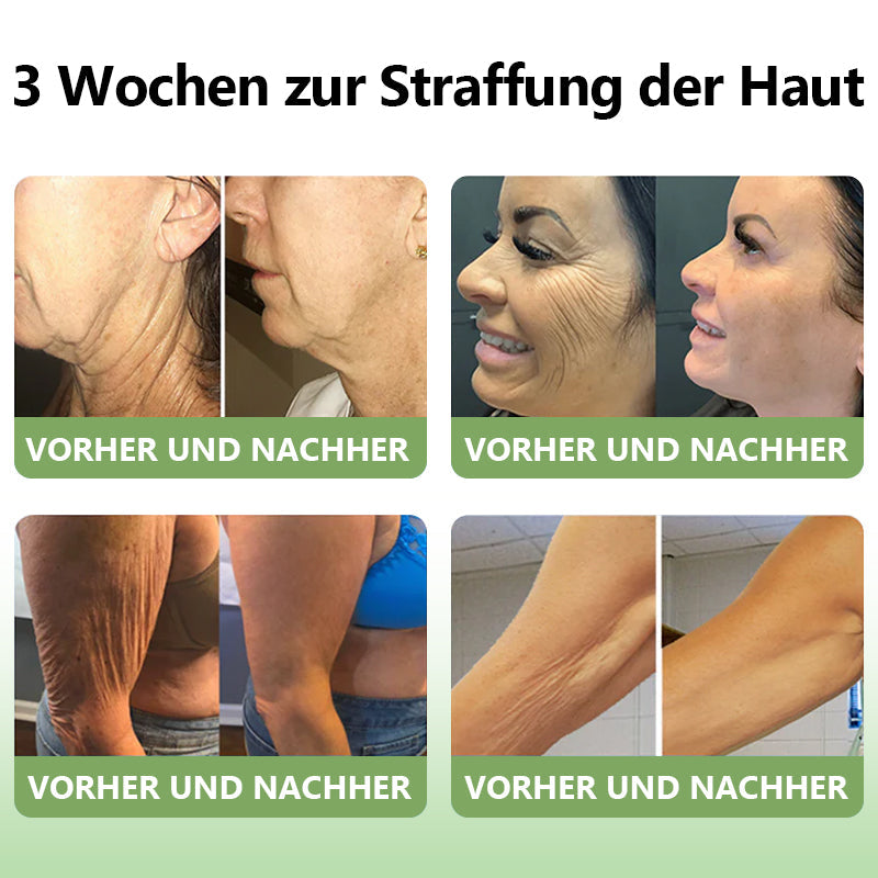 ✅ Offizieller Shop: STDEI™ Luxuriöse Kollagen-Festigungscreme  (BfArM-zertifiziert👨‍⚕️) | Strafft die Haut, Reduziert Falten, Kehrt Alterserscheinungen um