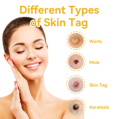 ✅[𝐎𝐟𝐟𝐢𝐳𝐢𝐞𝐥𝐥𝐞𝐫 𝐋𝐚𝐝𝐞𝐧]:5 Tage zu makelloser Haut 👩‍⚕️ 𝐷𝑜𝑟𝑚𝑜𝑟𝑛𝑎™𝑩𝒊𝒆𝒏𝒆𝒏𝒈𝒊𝒇𝒕 𝑴𝒂𝒖𝒍𝒘𝒖𝒓𝒇 & 𝑾𝒂𝒓𝒛𝒆 𝑬𝒏𝒕𝒇𝒆𝒓𝒏𝒖𝒏𝒈 𝑪𝒓𝒆𝒎𝒆 (𝐄𝐧𝐣𝐨𝐲 𝟑𝟎% 𝐨𝐟𝐟 𝐧𝐨𝐰! 𝐋𝐢𝐦𝐢𝐭𝐞𝐝 𝐭𝐢𝐦𝐞 𝐨𝐟𝐟𝐞𝐫!)